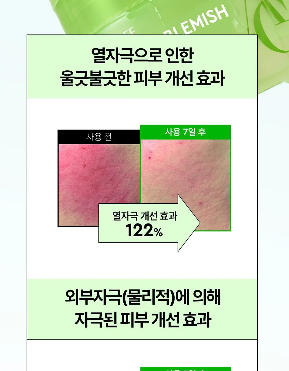 [트러블/잡티] 듀이트리 AC 딥 진정 패드 2종 택1 (모공/미백) 상세페이지 59